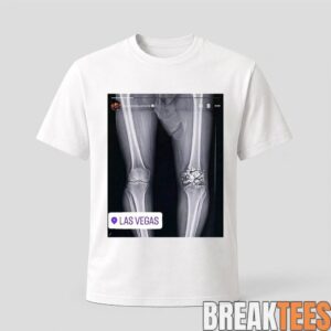 Conor McGregor X-Ray Broken Knee Knee Shirt