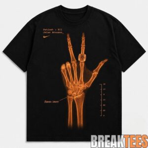 New York Knicks Jalen Brunson Wrist Surgery X-Ray Shirt 1